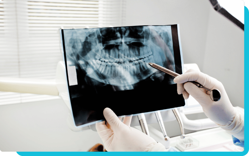 nerovet ai dental